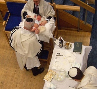 Circumcision, a fundamental rite in Judaism, has been a part of Jewish life for nearly 4,000 years.